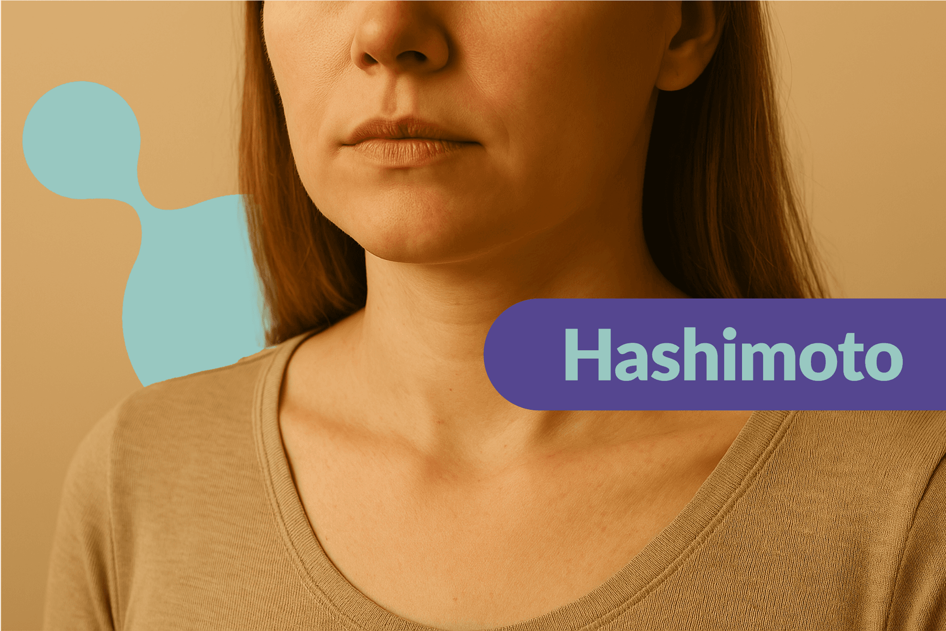 Choroba Hashimoto: objawy, badania, leczenie, dieta