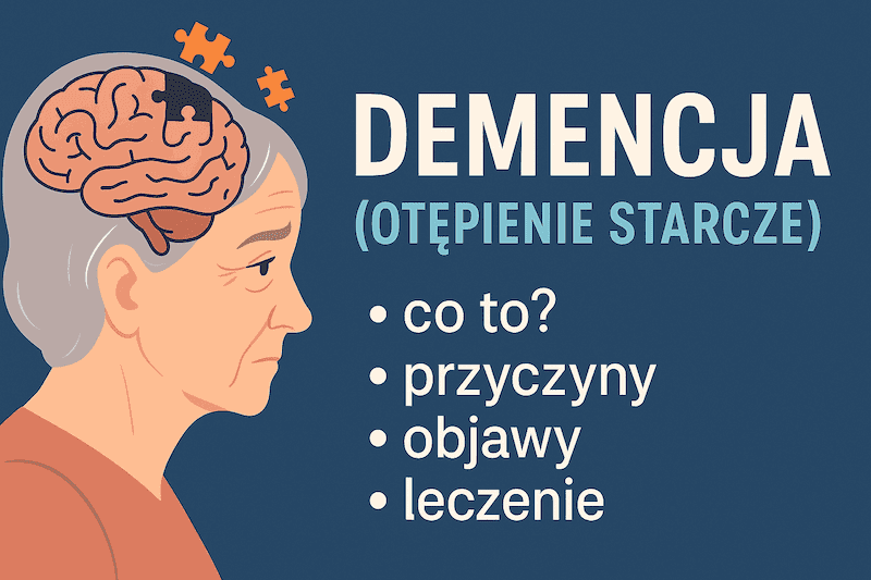 Demencja (otępienie starcze): co to, przyczyny, objawy, leczenie