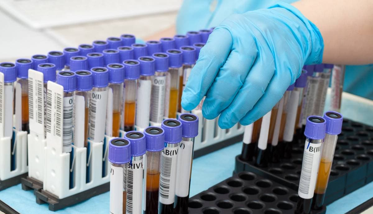 Morfologia krwi (ogólna i z rozmazem): czym jest, badanie, parametry, normy