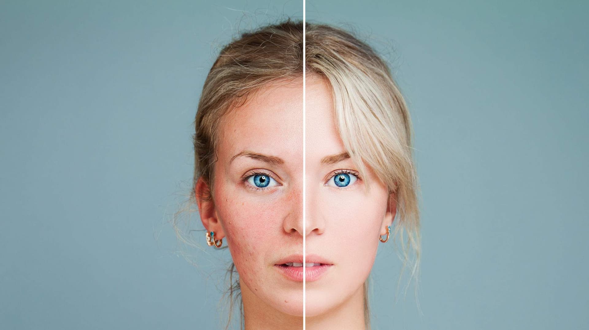 Choroby skóry: wszystko, co musisz wiedzieć