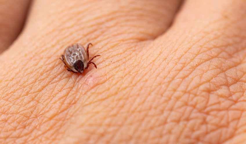 Borelioza: czym jest choroba przenoszona przez kleszcze?