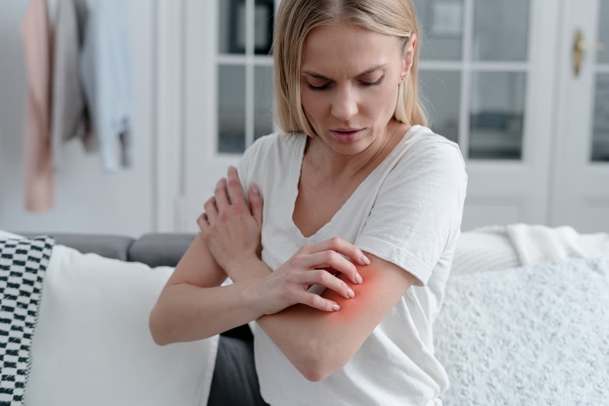 Atopowe zapalenie skóry. Objawy, przyczyny, leczenie, czyli wszystko co powinieneś wiedzieć o AZS