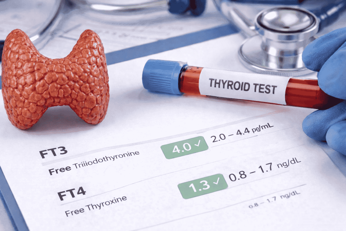 FT3 i FT4: czym są i jak czytać wyniki?