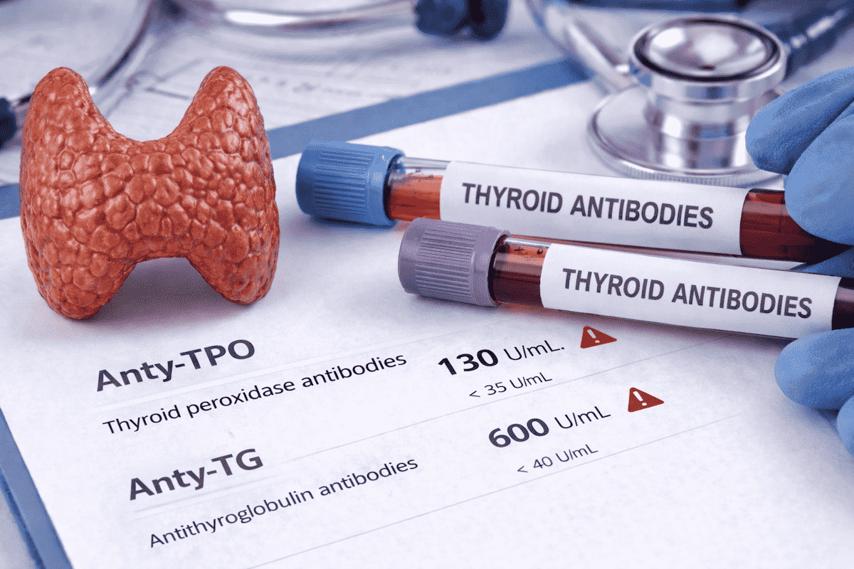 Anty-TPO i anty-TG: co oznaczają przeciwciała?